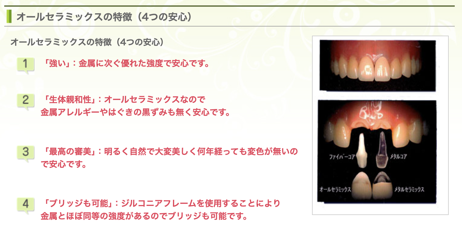 オールセラミックスを使用した治療を行い、見た目の美しさと機能性を重視しています
