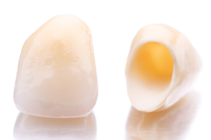 セレックセレックはむし歯の再発リスクを抑えることができます。