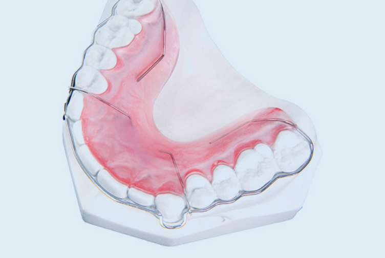 小さくて目立たない矯正装置もあります。