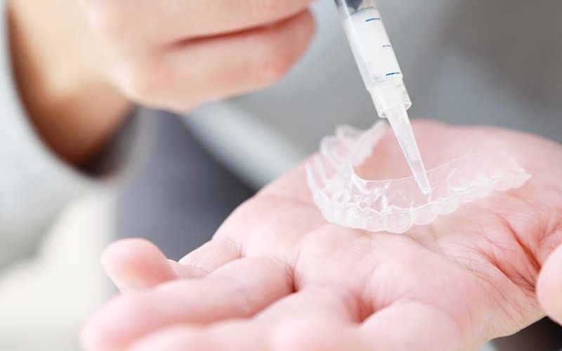 患者様が納得できる方法で自然な明るさを目指しています。