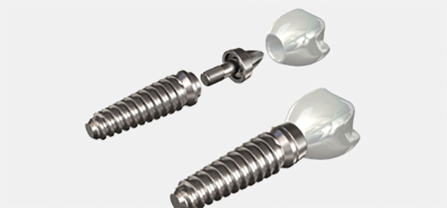 安心と信頼の10年保証付きインプラント