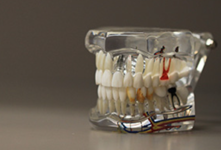 健康な歯を守る 歯周病治療の重要性とは