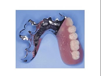 総入れ歯・部分入れ歯ともに対応しています