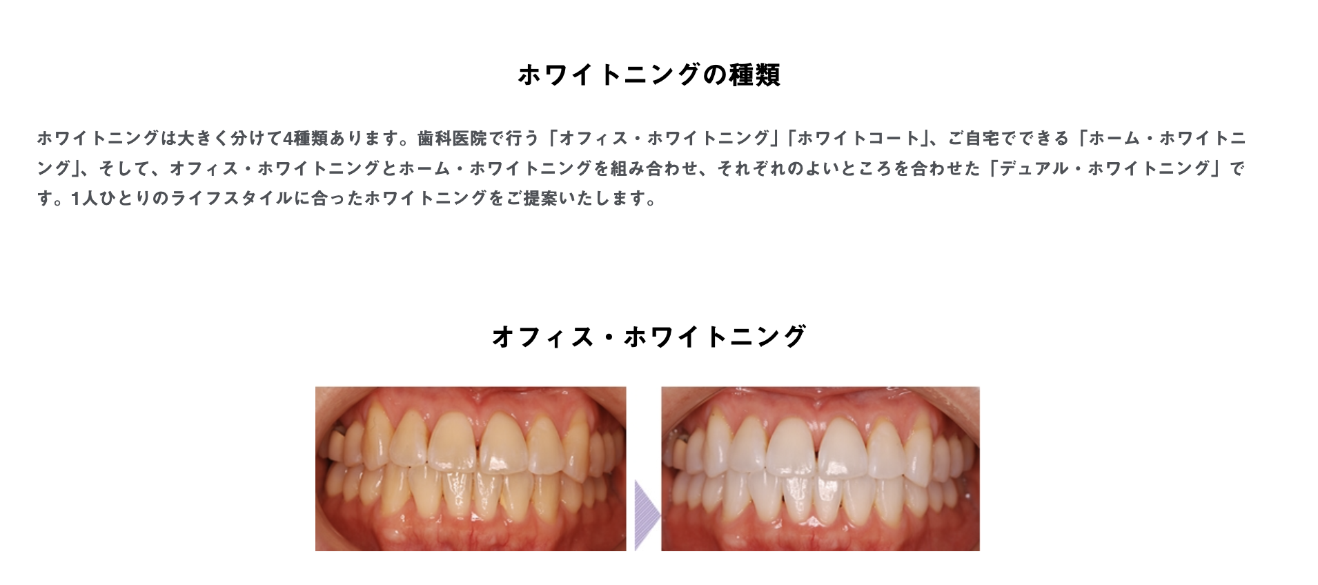 白く輝く歯を手に入れたいと考えている方に、安心して治療を受けていただける環境を整えています