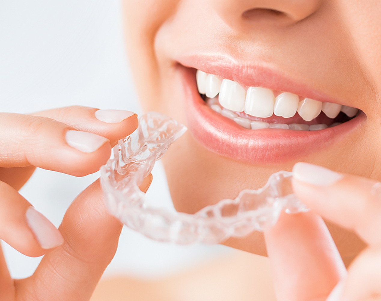 インビザラインも取り扱っています