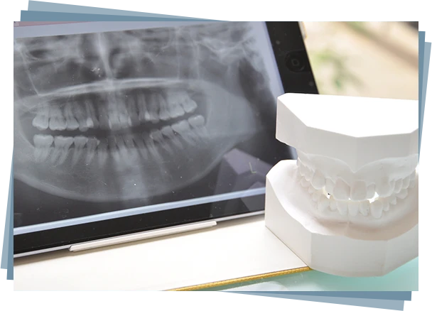 口のケガや痛みに素早く対応