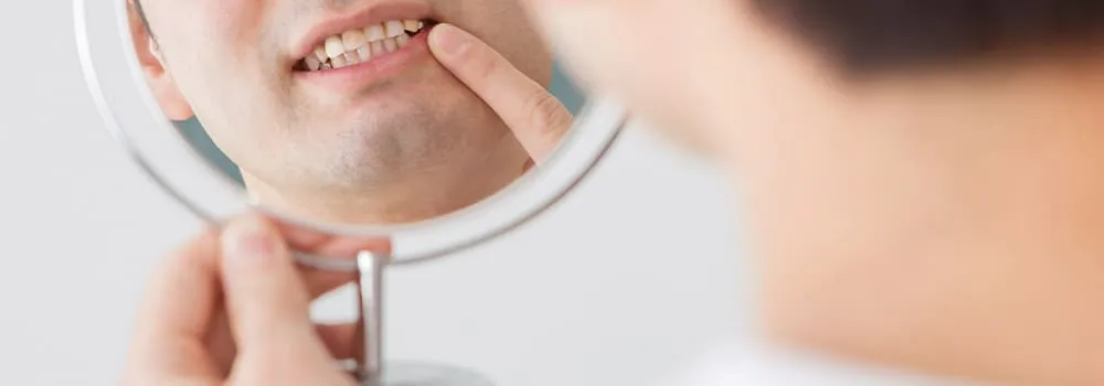 患者様一人ひとりに合わせた矯正計画を立てています