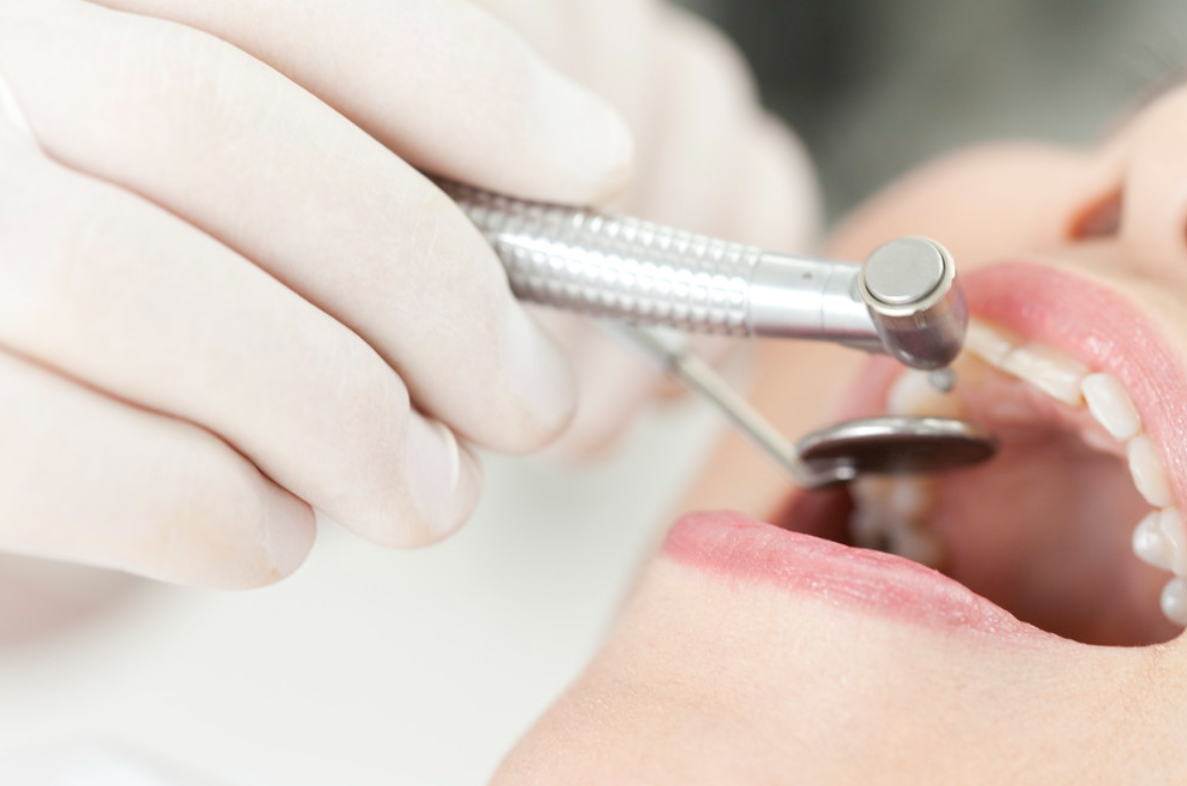 最新技術と確かな経験で、安心・安全な虫歯治療を提供いたします