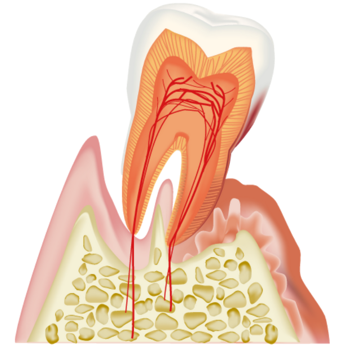 失ってしまった歯の土台である歯周組織に対して再生治療を行うことも可能です。