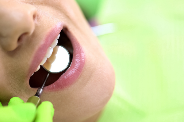 ※画像はイメージです