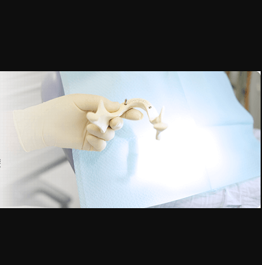 インプラント治療