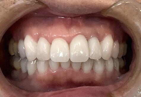 むずかしい症例にも対応可能です