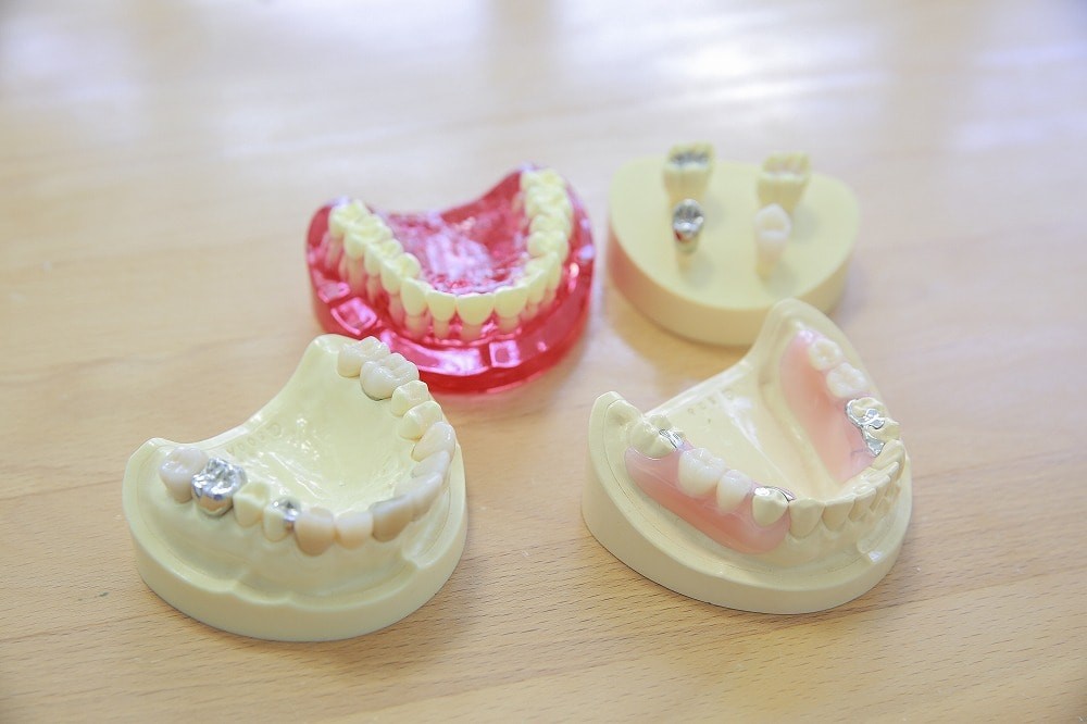 保険適用の入れ歯に加え、金属製の留め具が目立ちにくいノンクラスプデンチャーや、薄く丈夫で食べ物の温度を感じやすい金属床を取り扱っています。