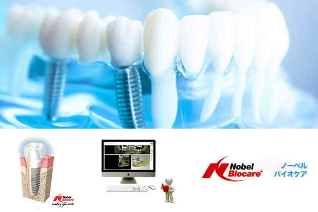 高品質・高水準のインプラント治療