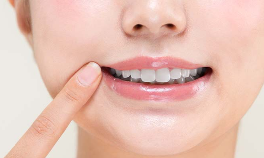 歯を美しくする治療です