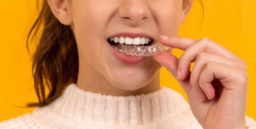 歯並びを美しく整える