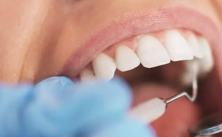 ホワイトニングの仕組みを理解していただくために、プロモーションビデオを見ながら進めることができます