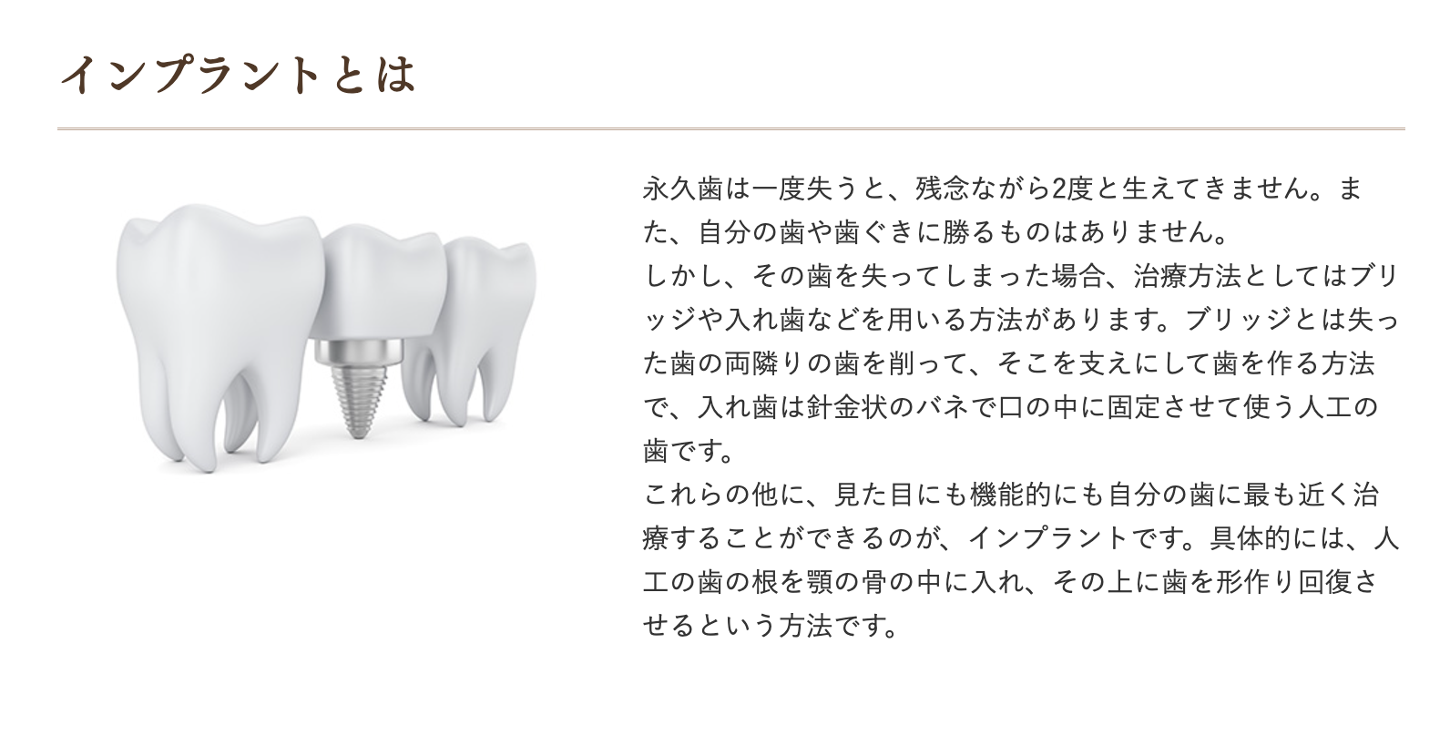 隣の健康な歯を削る必要がないため、他の歯に余計な負担をかけることもありません