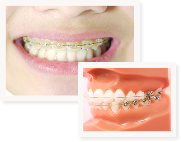 噛み合わせの乱れによる負担を減らす調整を重視します