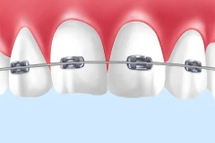 見た目と機能、どちらも大切にした矯正治療で、患者様の笑顔を支えています。