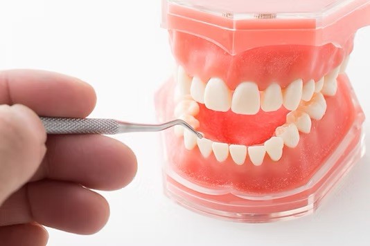 歯の噛み合わせの状態を確認し、噛む際のバランスや顎の動きに問題がないかを丁寧に診査しています。