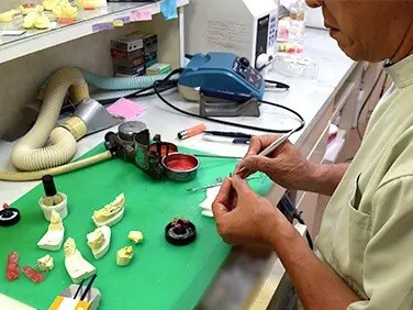 院内に歯科技工士が在籍