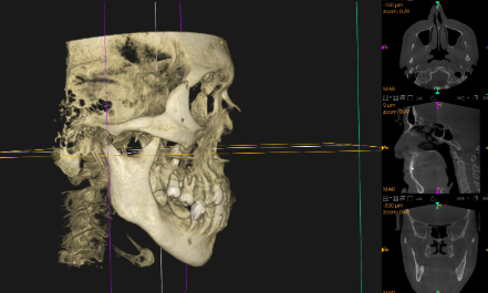 ①診療室　②治療ユニット　③レントゲン