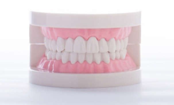 精密義歯は、快適で自然な装着感を提供します。