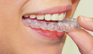 簡単に取り外しが可能です