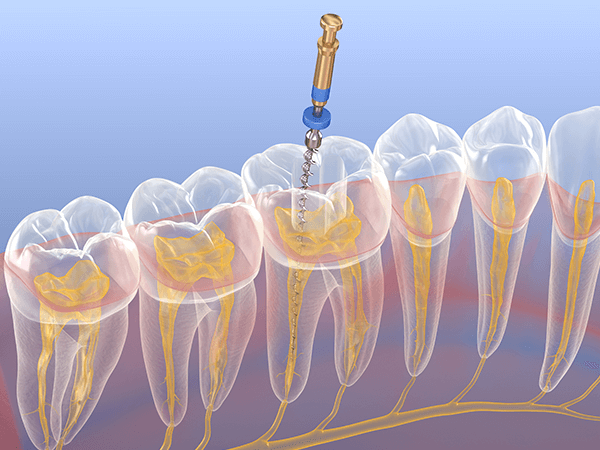 完全個室の診療室で安心して治療を受けていただけます