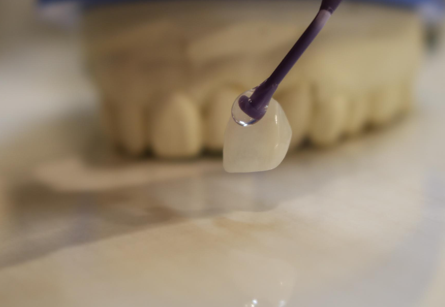 セラミック矯正は、美しい歯並びと白い歯を短期間で実現するための理想的な治療法です