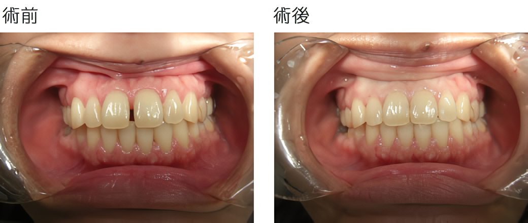 ライフスタイルに合わせた矯正治療で、美しさと健康を両立