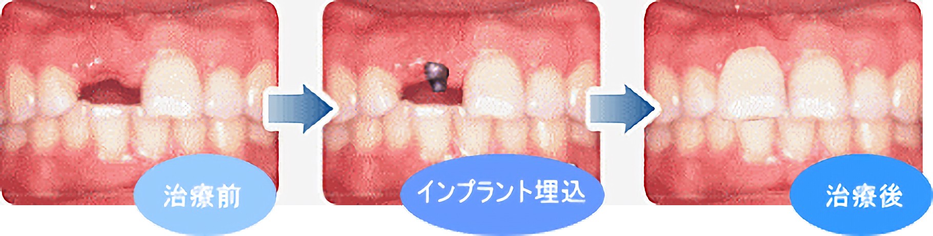 症例