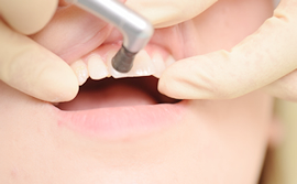 健康な歯を維持しましょう