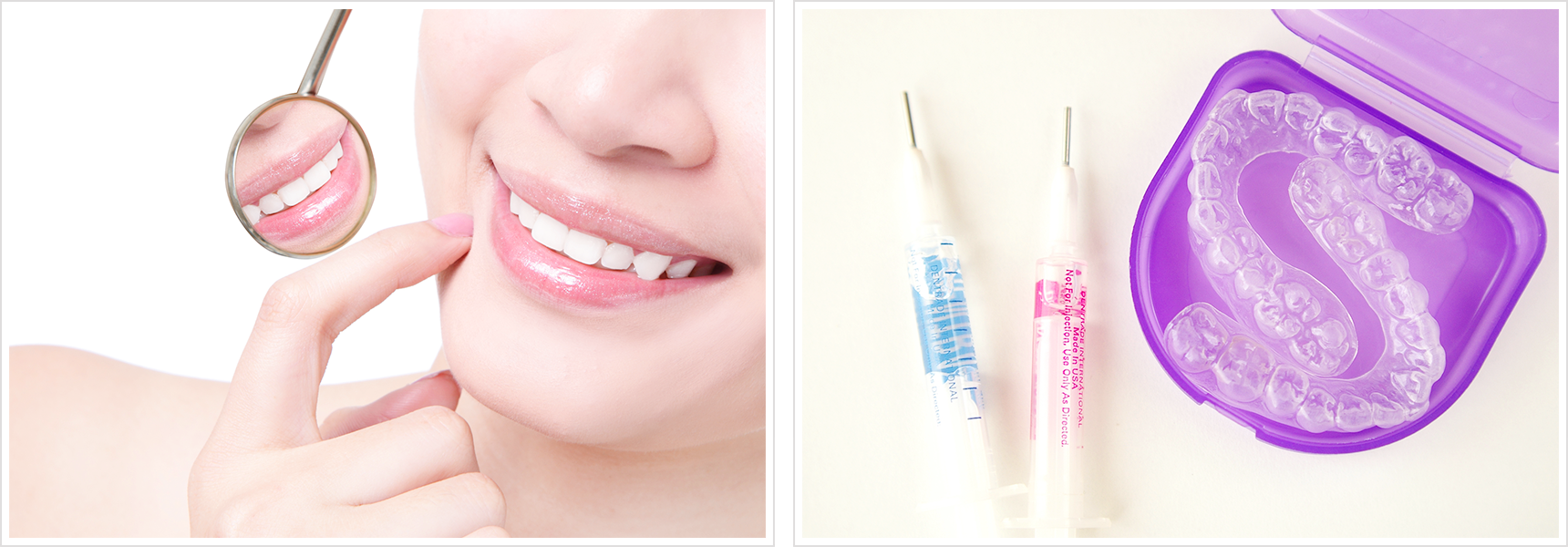 歯を削らず白さを整えています