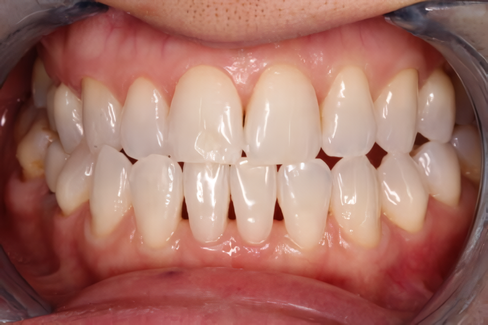 綺麗な歯並びは印象を良くします