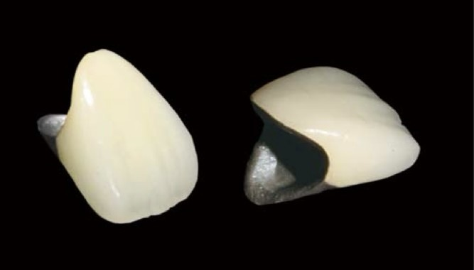 見た目も機能も大切にする、こだわりのセラミック治療