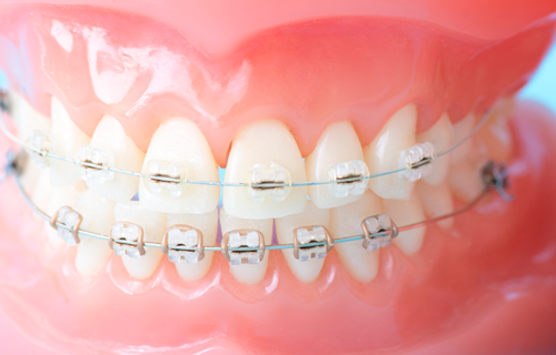 美しさと機能性を両立する長期的に安定した歯並びの実現