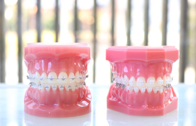 患者様に合わせた入れ歯治療で、自然な噛み心地を提供