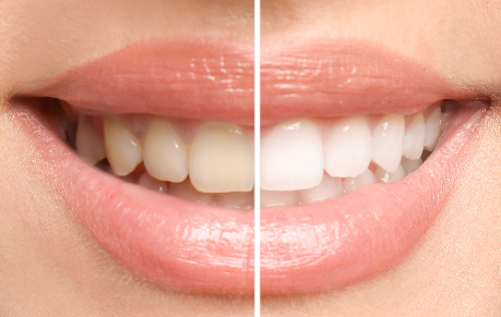 美しい笑顔と自然な歯を手に入れるための審美歯科治療を提供し、患者様の自信と満足度を高めるお手伝いをしています。