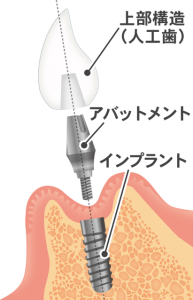 安心してお任せください