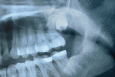 早めの受診をおすすめします