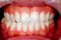 白い歯で素敵な笑顔を