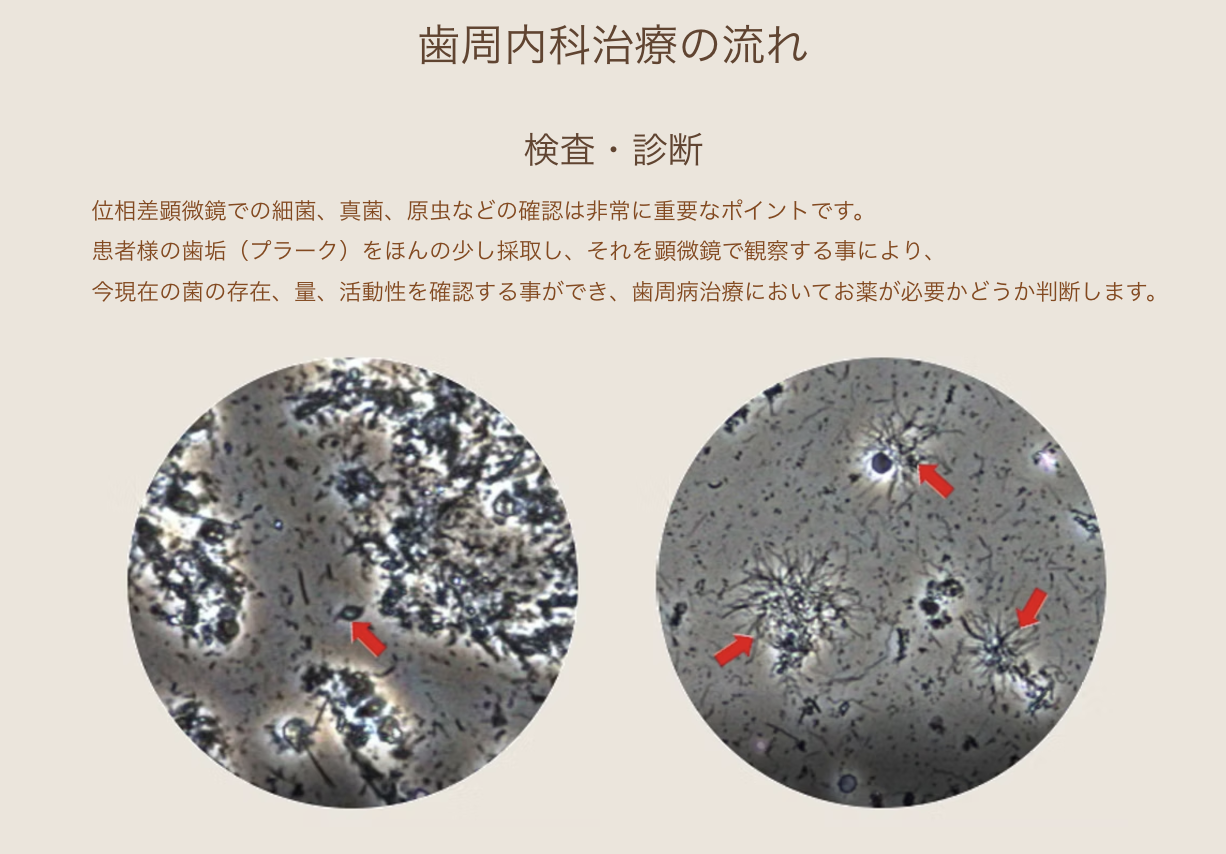 位相差顕微鏡での再確認や歯石除去を通じて、お口の健康を長期間維持できるようサポートします