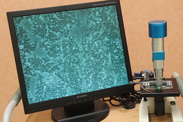 治療前に位相差顕微鏡を用いた歯周病菌検査を実施しています