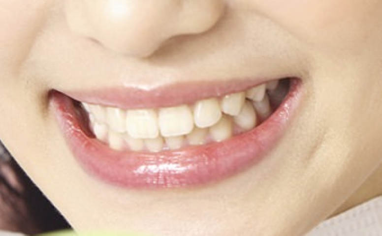 健康と笑顔を支えるクローバー歯科の理念