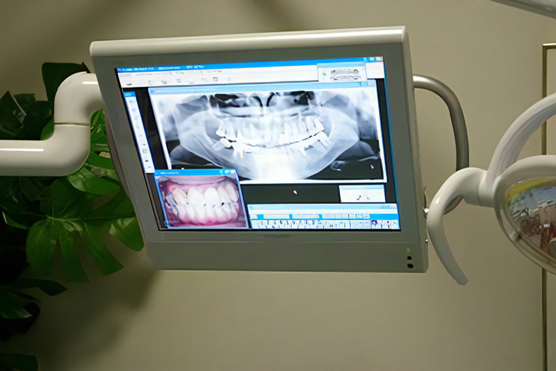 治療前には詳しい検査をします