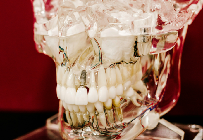 自然な咀嚼を目指せることがインプラントの魅力です。