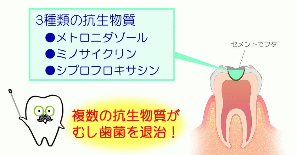 神経を守り、痛みを抑えた治療で歯の健康を長く維持します