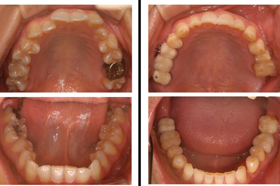 安藤メソッドで健康的に